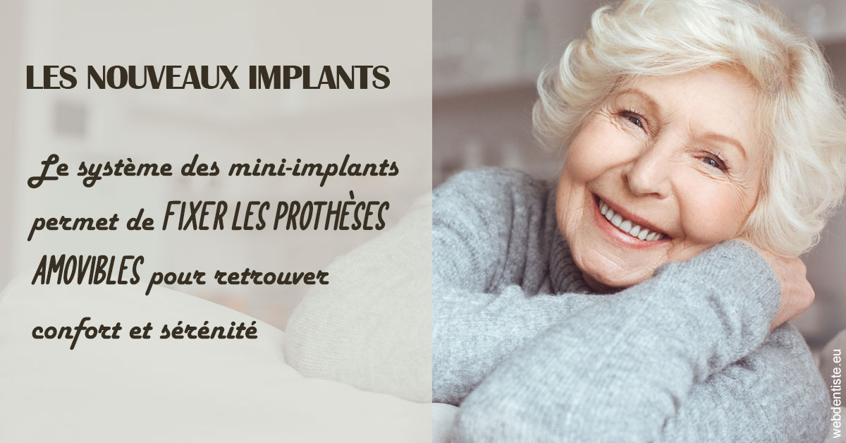 https://www.dr-amar.fr/Les nouveaux implants 1