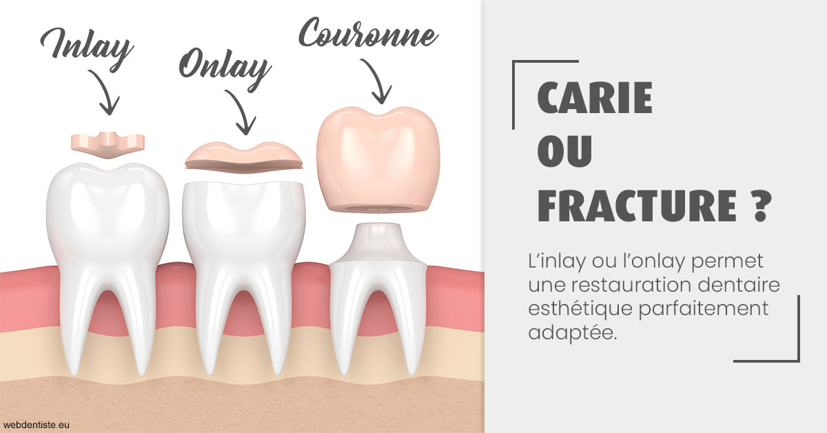 https://www.dr-amar.fr/T2 2023 - Carie ou fracture 1