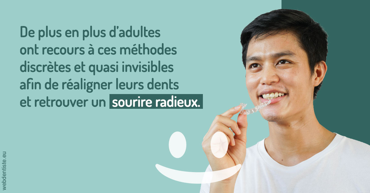 https://www.dr-amar.fr/Gouttières sourire radieux 2