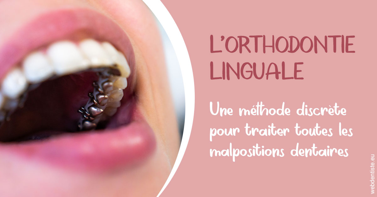 https://www.dr-amar.fr/L'orthodontie linguale 2