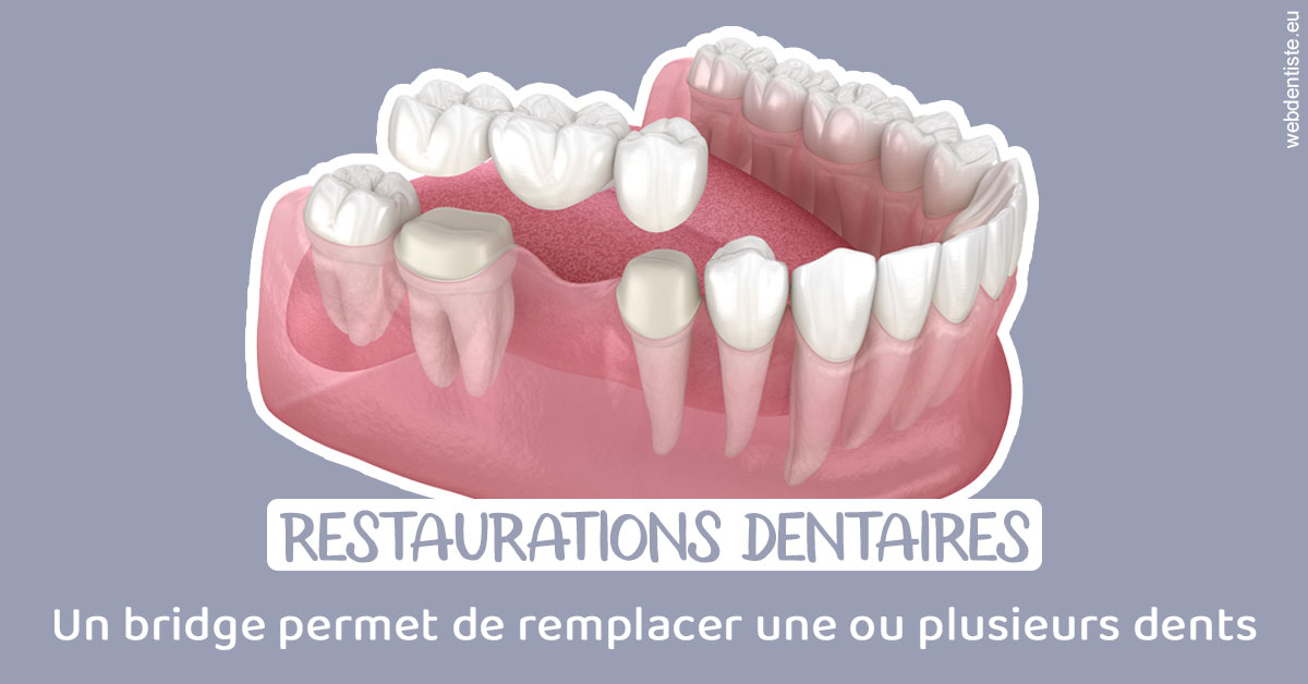 https://www.dr-amar.fr/Bridge remplacer dents 1