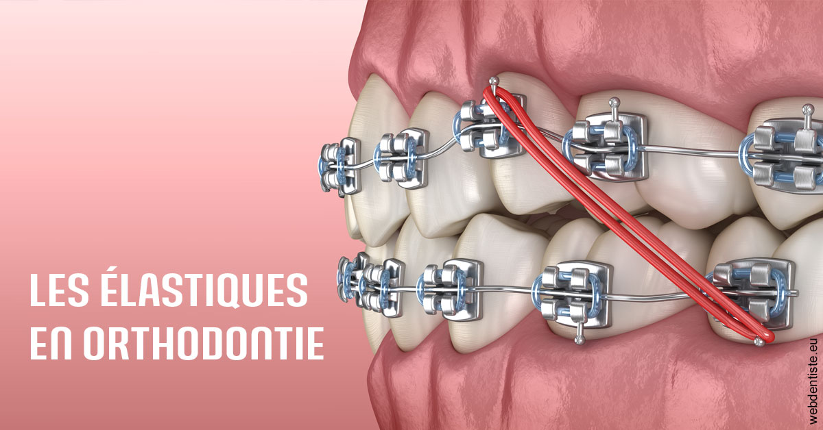 https://www.dr-amar.fr/Elastiques orthodontie 2