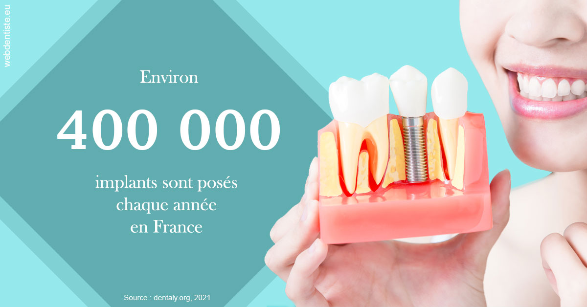 https://www.dr-amar.fr/Pose d'implants en France 2